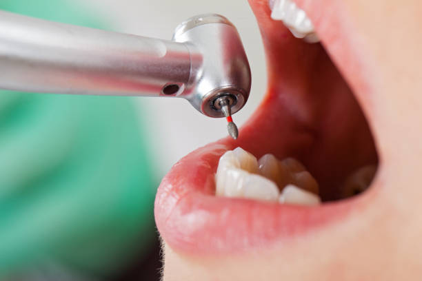 Best Emergency Dentist for Knocked-Out Tooth in Crescent City, FL